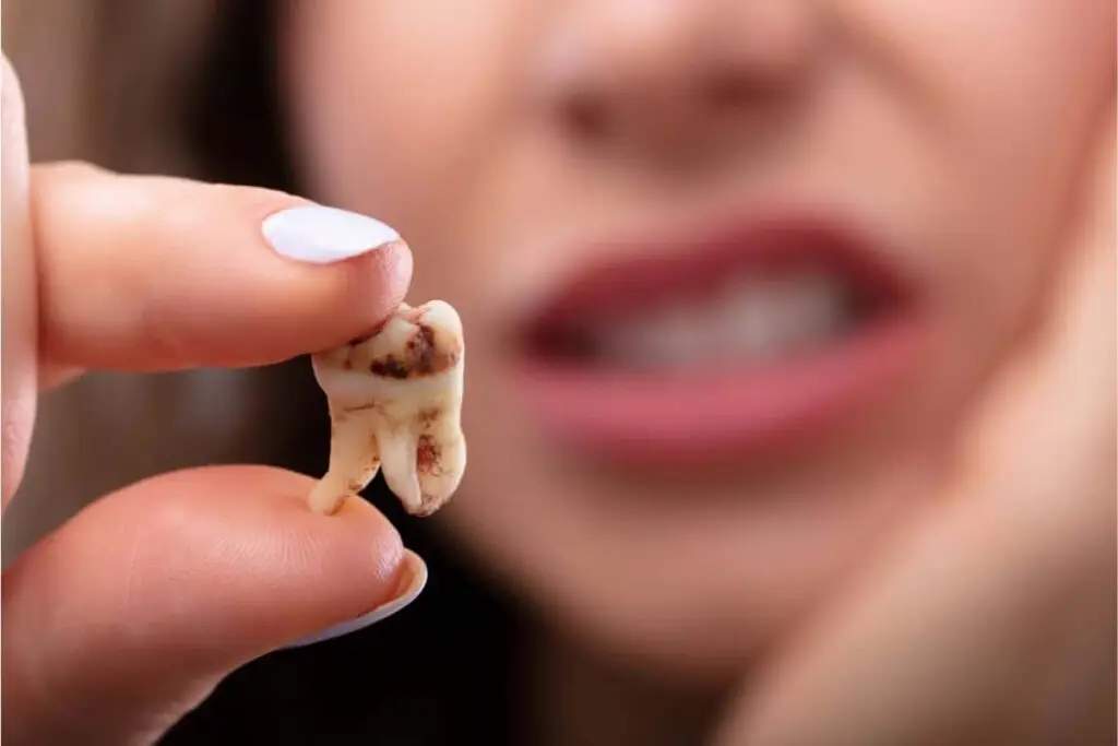 Are your wisdom teeth causing discomfort?